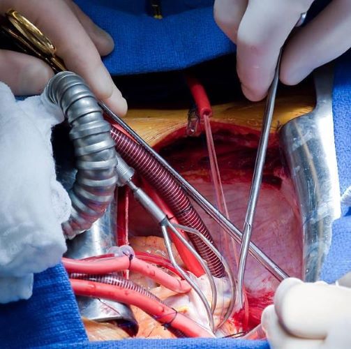 fondation opération ouverte